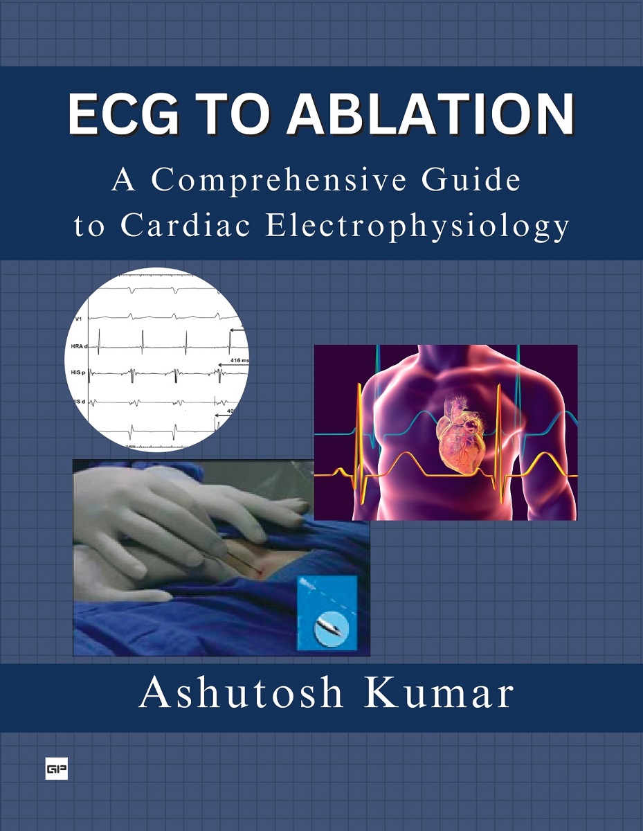 ECG TO ABLATION: A COMPREHENSIVE GUIDE TO CARDIAC ELECTROPHYSIOLOGY